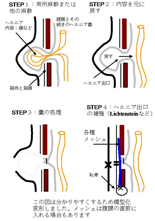 埼玉医科大学総合医療センター 消化管外科・一般外科